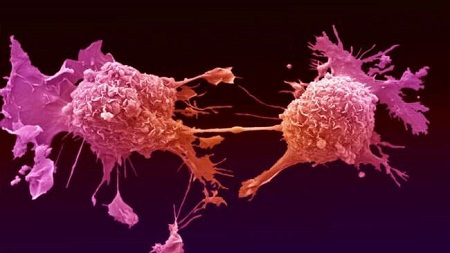 Phát hiện trường hợp tế bào ung thư truyền từ mẹ sang con
